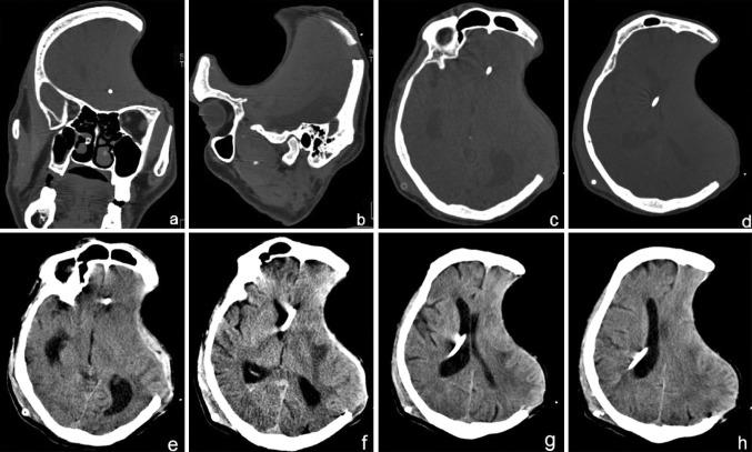 Fig. 3