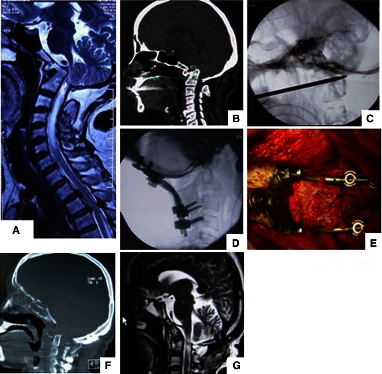 Fig. 2