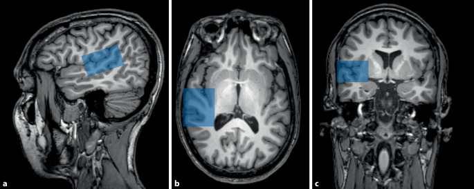 graphic file with name 106_2023_1319_Fig2_HTML.jpg