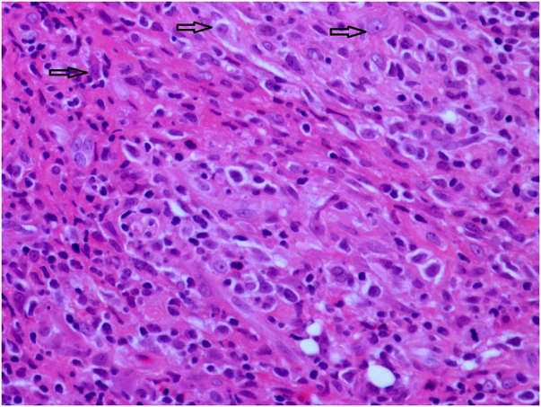 Figure 2 