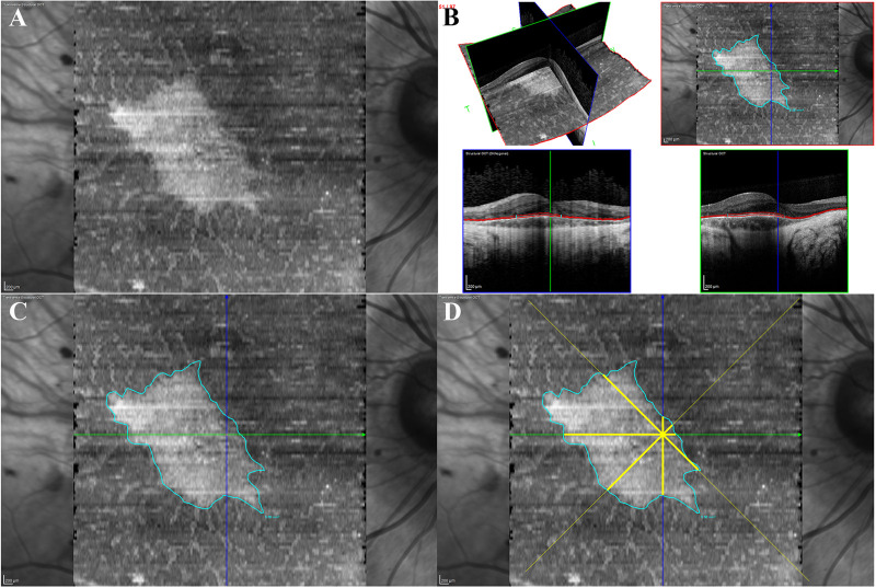 Figure 2.