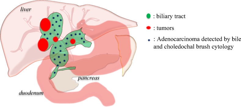 Fig. 2