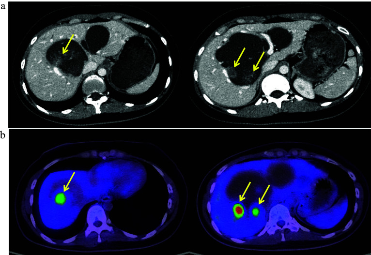 Fig. 1