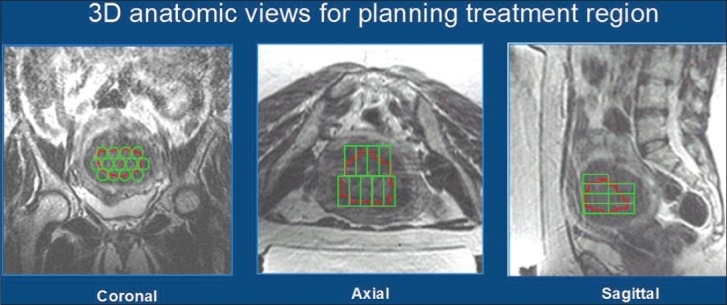 Figure 1a