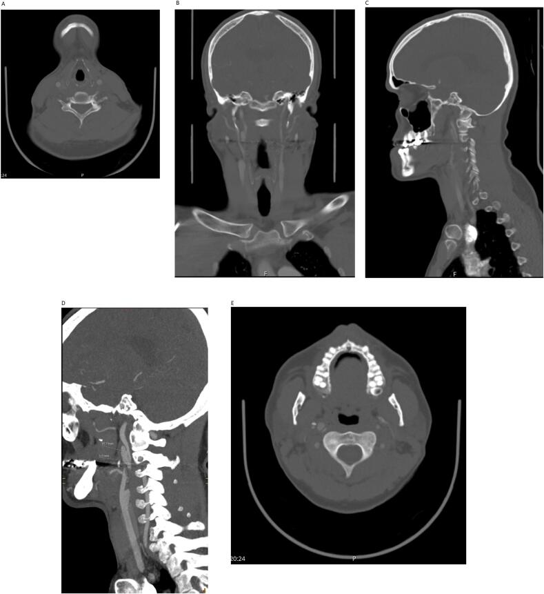 Fig. 1