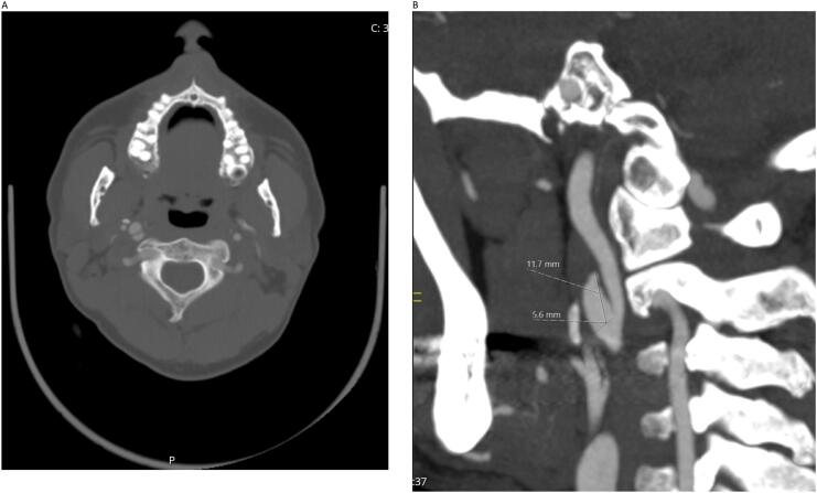 Fig. 4