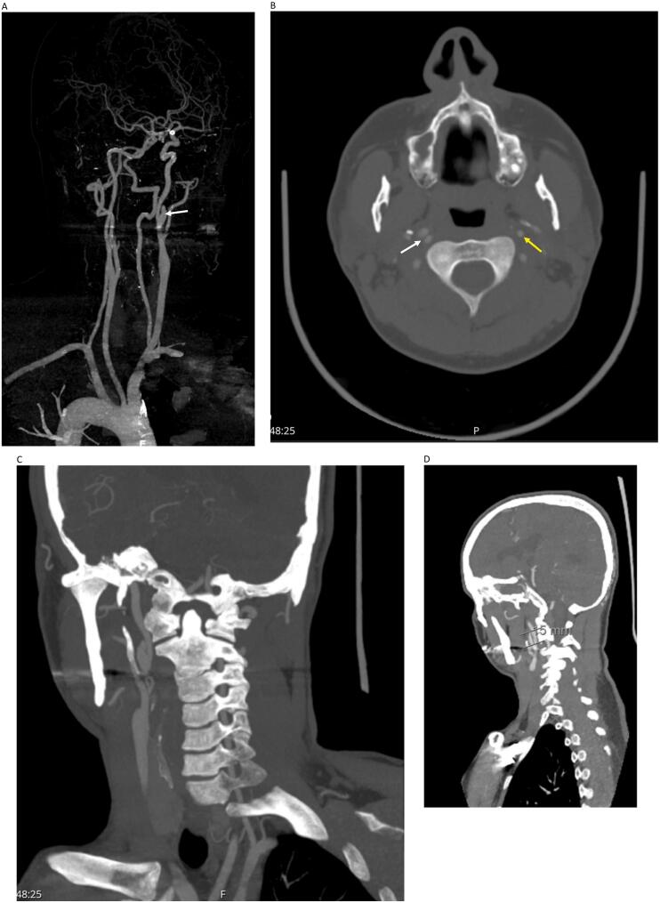 Fig. 3