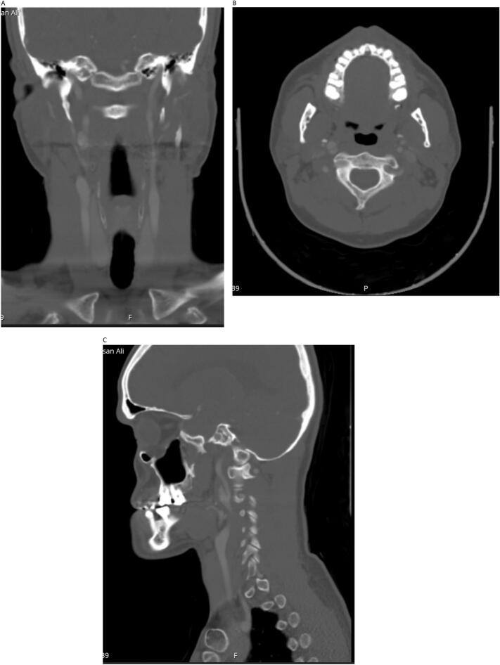 Fig. 5