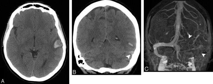 Fig 4.