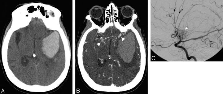 Fig 6.