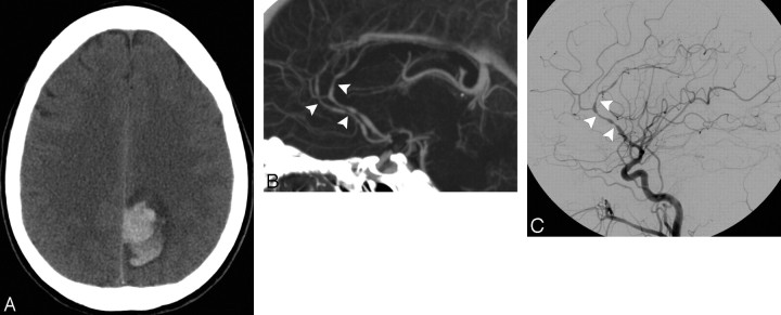 Fig 5.