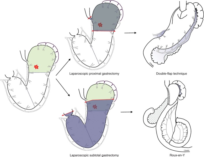 BJS5-50241-FIG-0001-c