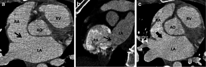 Fig. 17