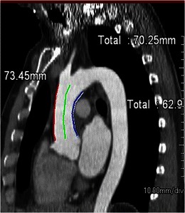 Fig. 14