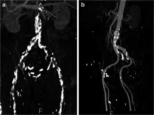 Fig. 11