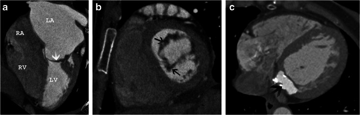 Fig. 12