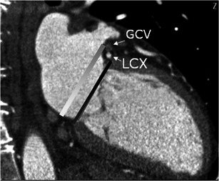 Fig. 15