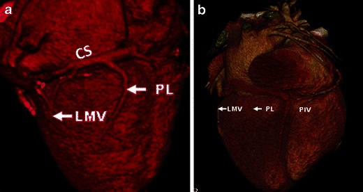 Fig. 19