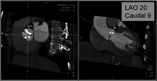 Fig. 10