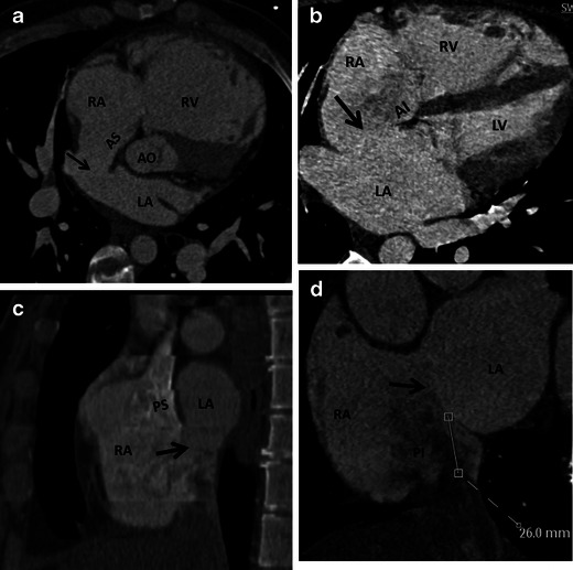 Fig. 16