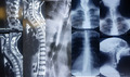 graphic file with name CCR3-8-999-g003.jpg