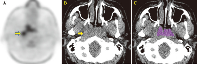 Fig. 1