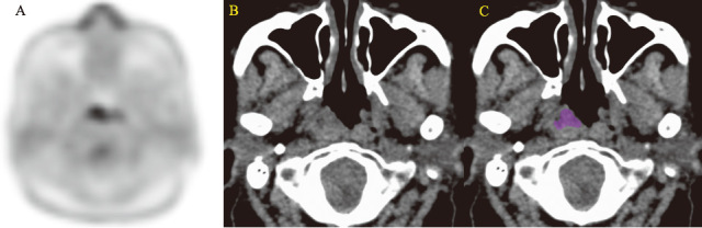 Fig. 2