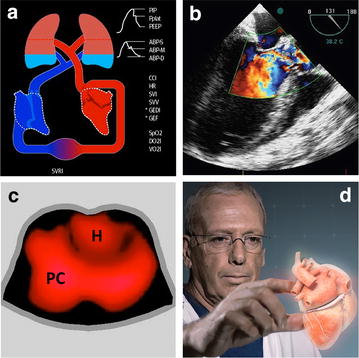 Fig. 2