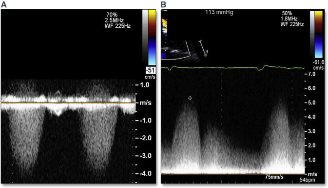 Figure 26