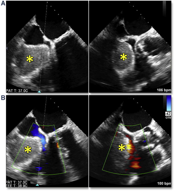 Figure 22