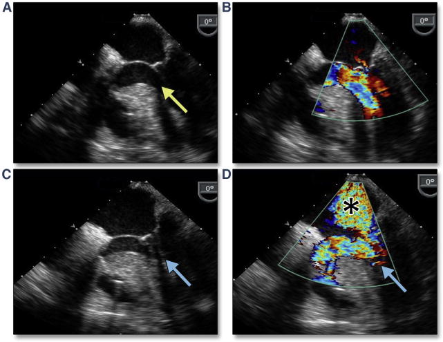 Figure 29