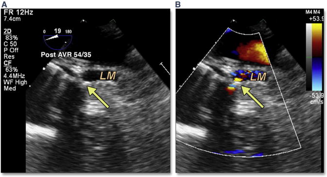 Figure 27