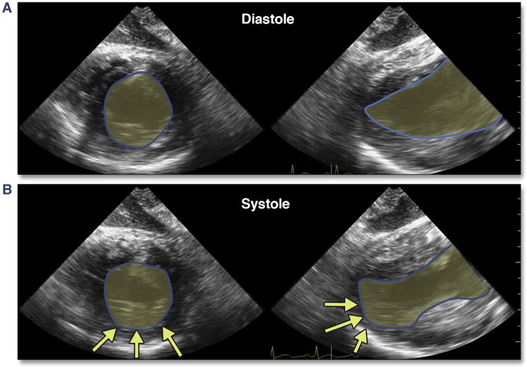 Figure 32