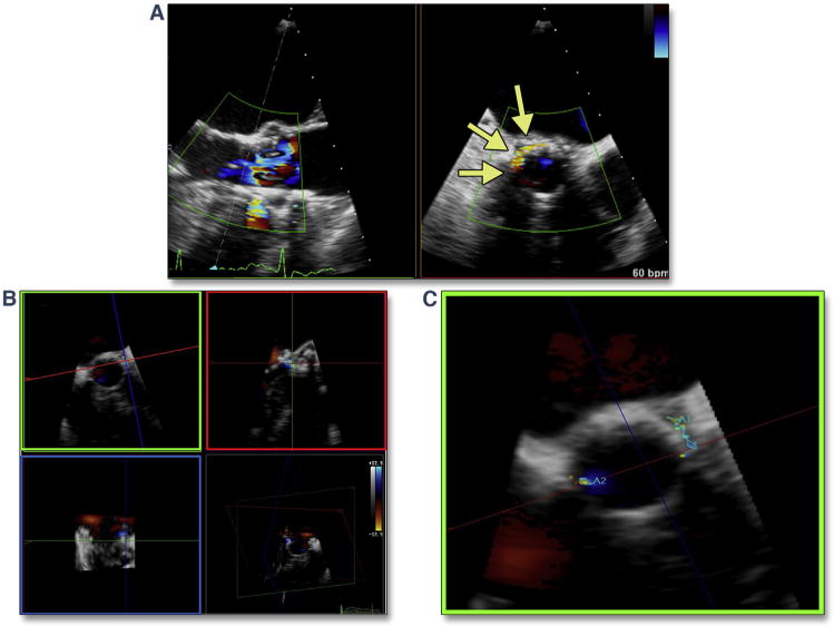 Figure 19