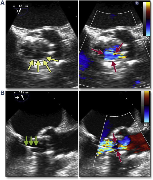 Figure 21