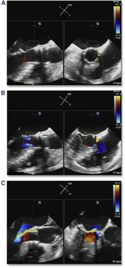 Figure 18