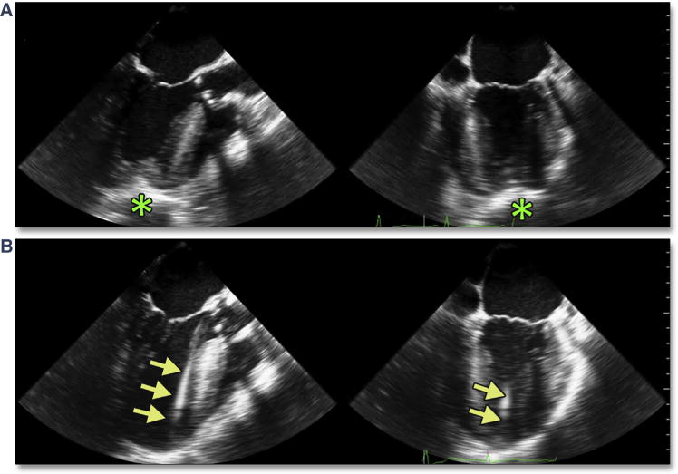 Figure 31