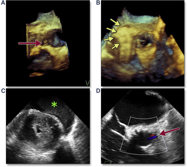 Figure 15