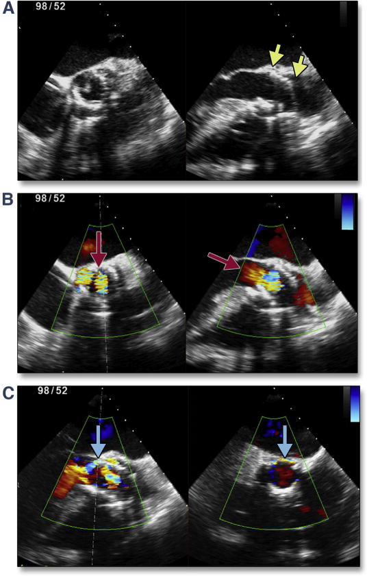 Figure 20