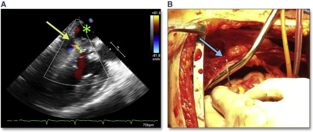 Figure 23