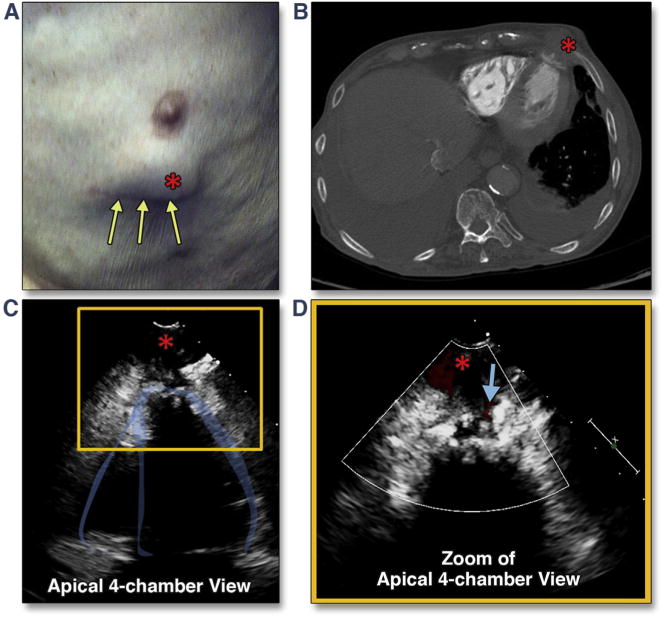 Figure 33