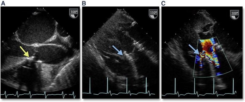 Figure 25