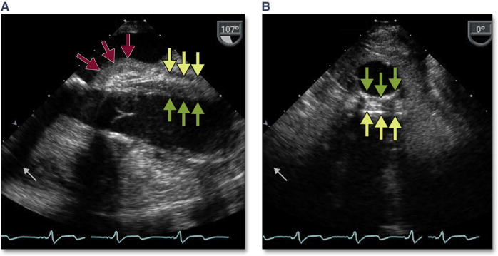 Figure 17