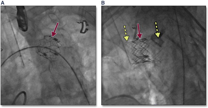 Figure 34