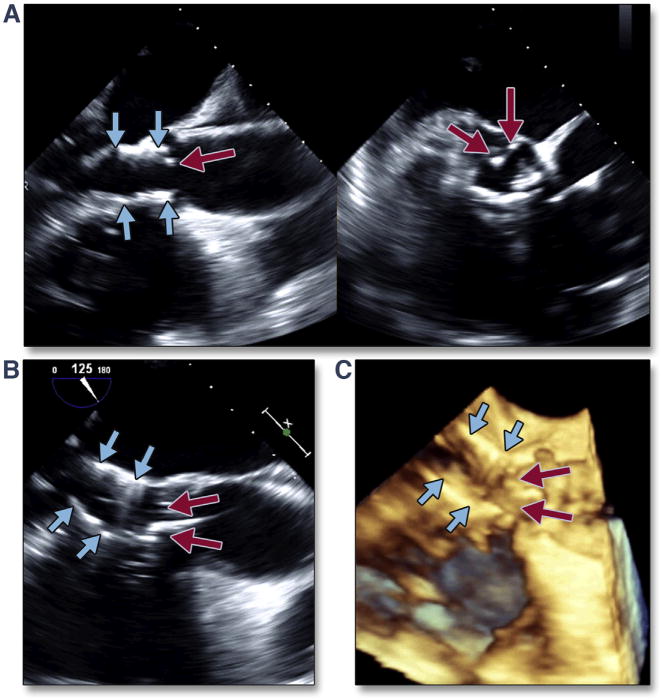 Figure 35