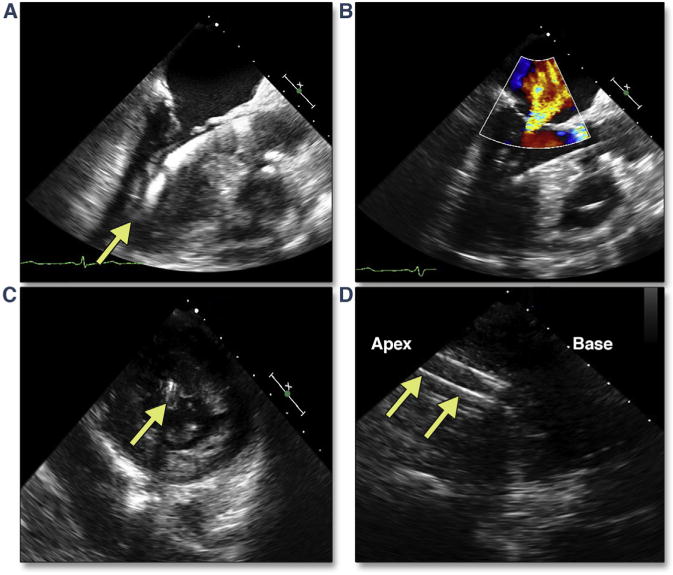 Figure 30