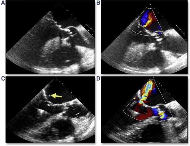 Figure 28