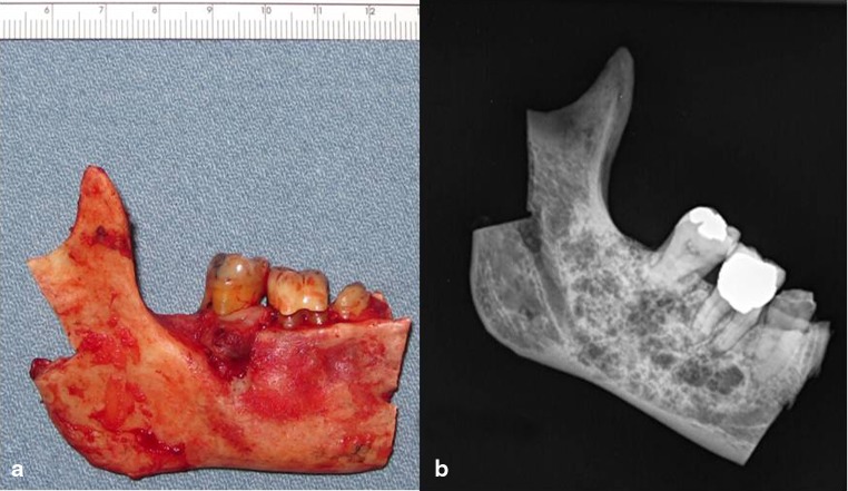 Fig. 5