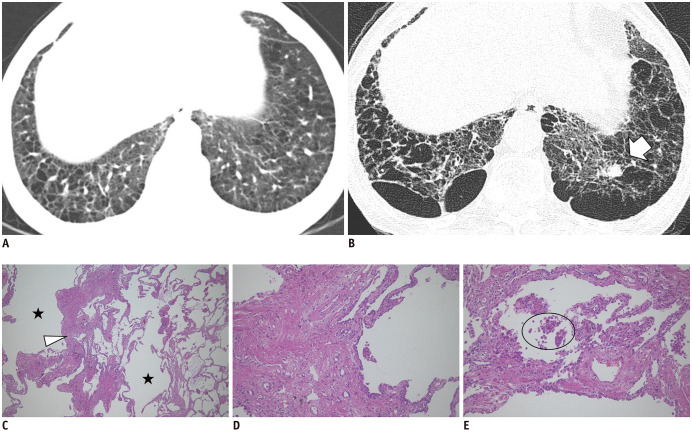 Fig. 11