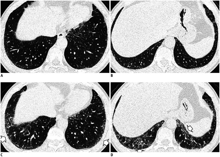 Fig. 10